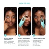 image:imageFOREO IRIS 2 Eye Massager  Dark Circles Puffiness amp Eye Bags  MintMint